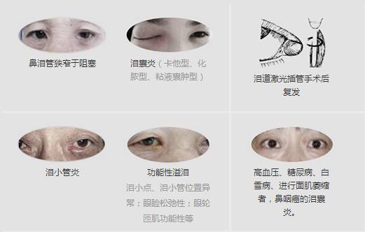 12月17日，普瑞集團淚道專家來疆親診，預約請速！
